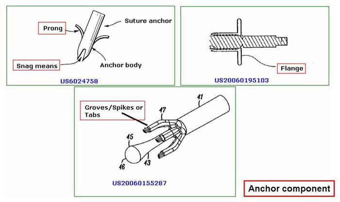 Anchor component comparative.jpeg